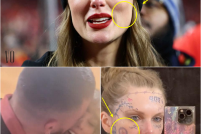 Fans believe Taylor Swift is in hiding and Travis Kelce is protecting her because she is recovering from plastic surgery