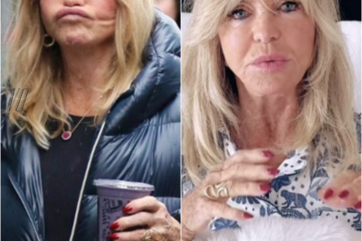 Goldie Hawn, 79, Leaves 2025 Oscars Viewers Shocked as Hollywood Icon’s ‘Face Looks Different’ — ‘Too Much Work Gone Wrong?’